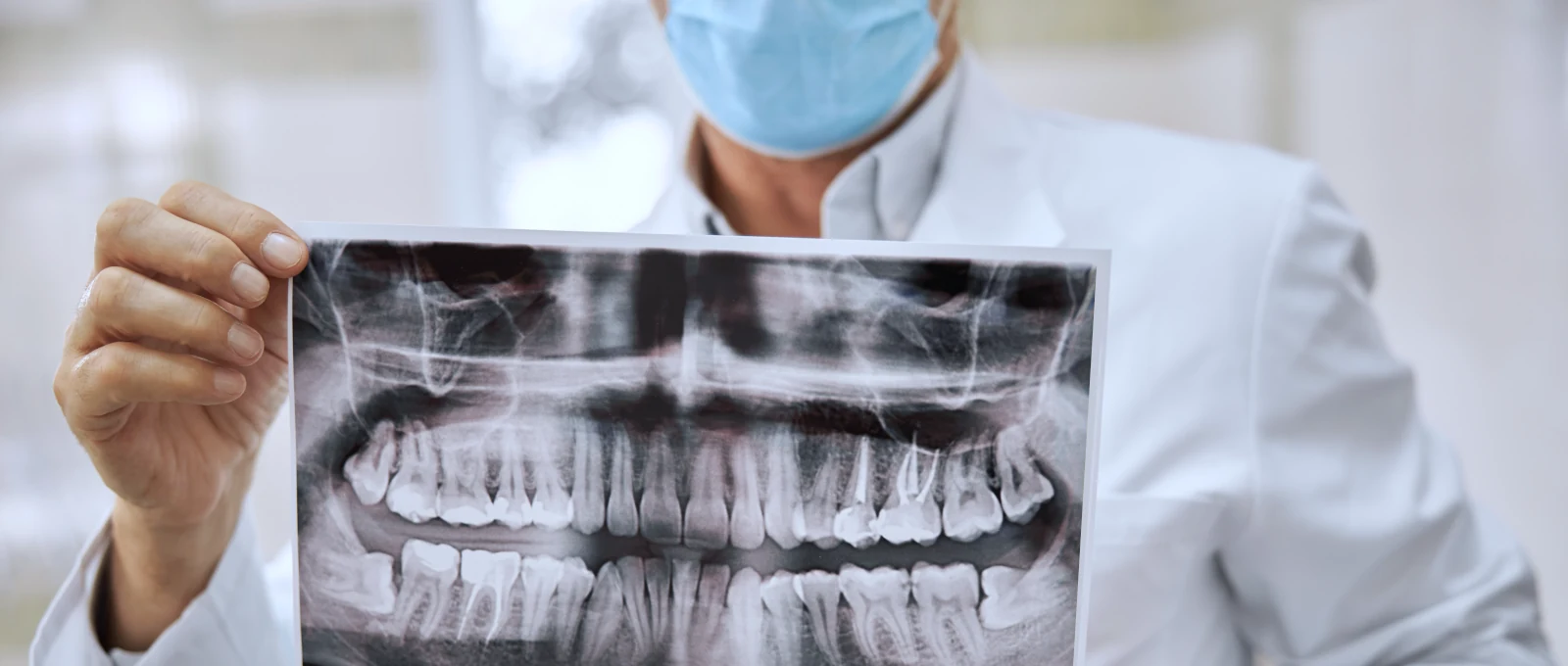 Usuwanie zęba - pacjent Krawdent Rzeszów